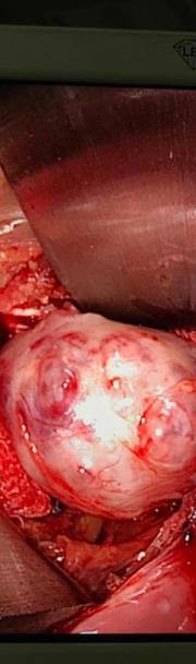 Photos of Minimal Access ENT Surgery Minimal access ENT surgery